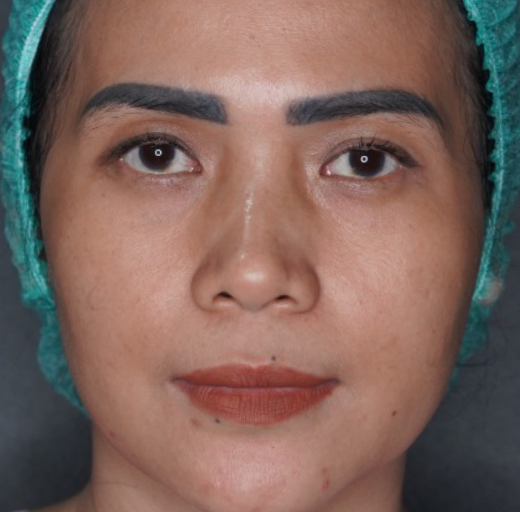 Before/After Image
